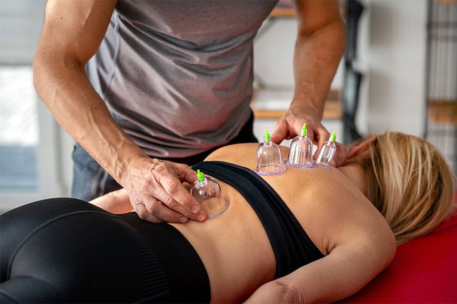 Cupping Therapy Michigan