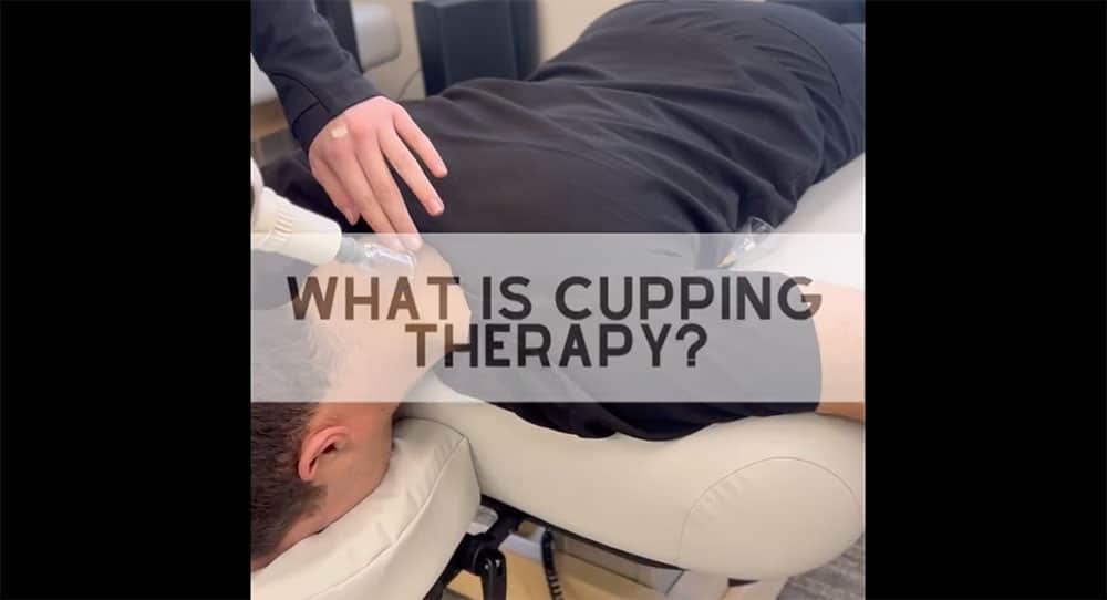 Cupping Therapy